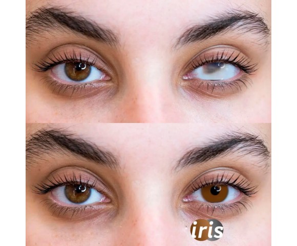 Протезні контактні лінзи MAXVUE® Iris (для щоденного носіння) 1 шт.